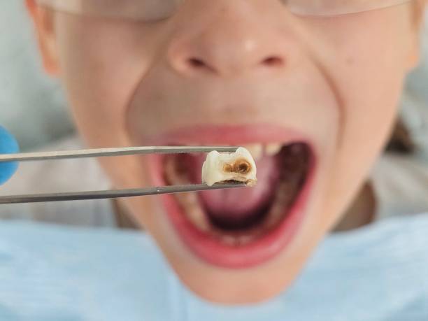 Best Broken or Chipped Tooth Repair in Hawley, PA